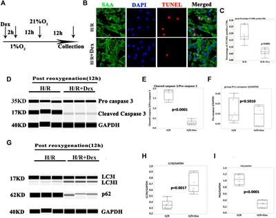 Dexmedetomidine Protects Human Cardiomyocytes Against Ischemia-Reperfusion Injury Through α2-Adrenergic Receptor/AMPK-Dependent Autophagy